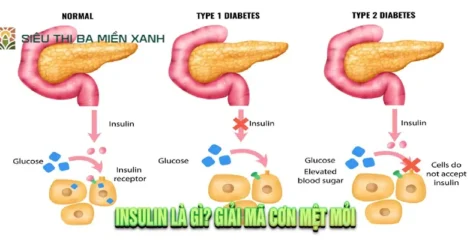 Insulin Là Gì? Giải Mã Cơn Mệt Mỏi, Thèm Ngọt & Hỗ Trợ Phòng Ngừa Tiểu Đường